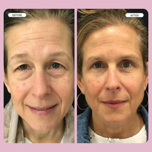 Lumi Instant Eye Tightener (+1 Free Brush)