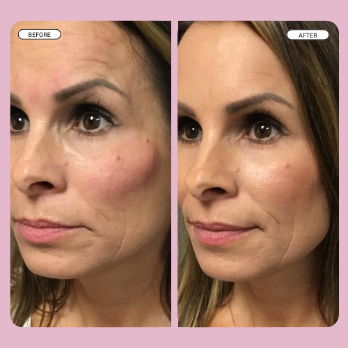 Lumi Instant Eye Tightener (+1 Free Brush)