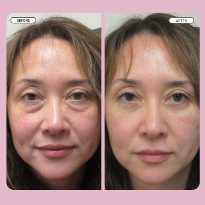 Lumi Instant Eye Tightener (+1 Free Brush)